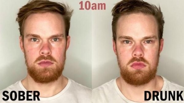 Парни пили алкоголь 12 часов подряд. Как изменилась их внешность