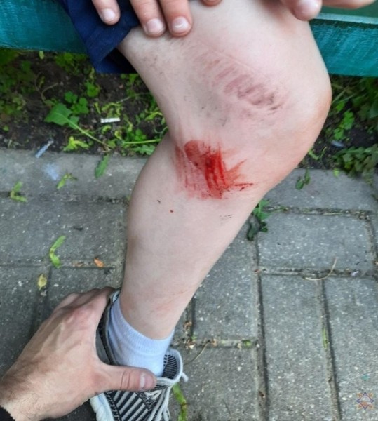 В Беларуси работники МЧС помогли мальчику, который застрял в приямке В Беларуси работники МЧС помогли мальчику, который застрял в приямке