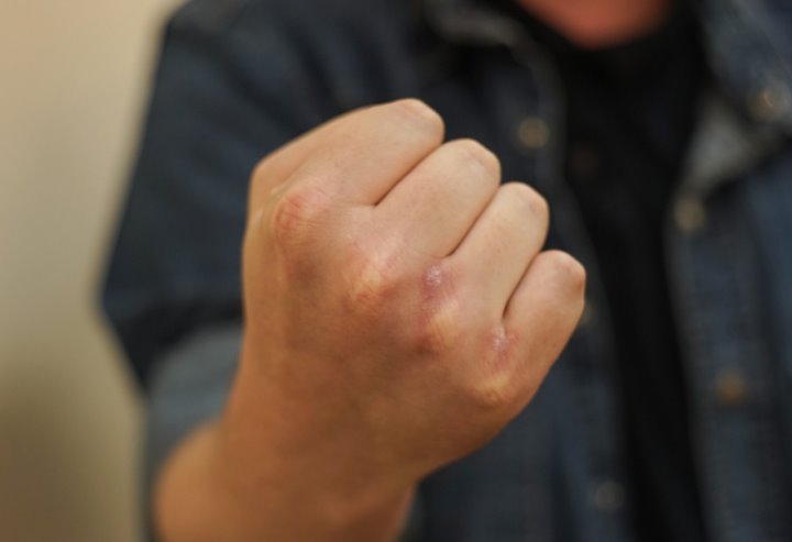 В Барановичском районе мужчина чуть до смерти не избил брата, который обидел свою сожительницу